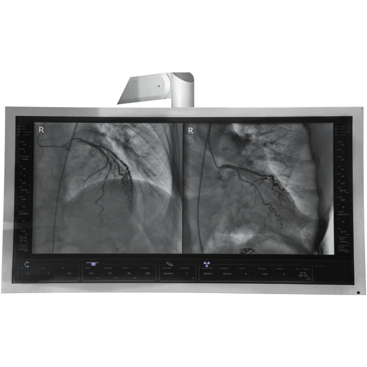 54 inch display dsa system.jpg
