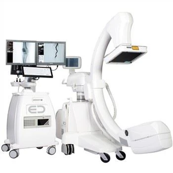 Idoralar tomonidan tasdiqlangan mobil angiografiya tizimi